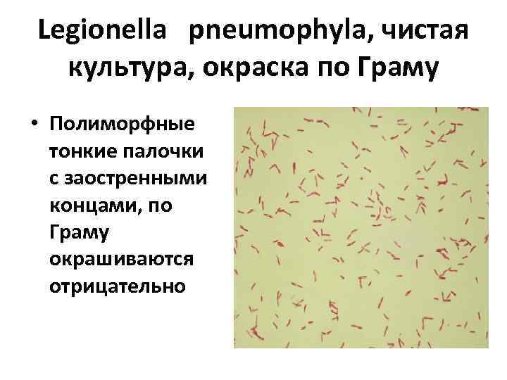 Legionella pneumophyla, чистая культура, окраска по Граму • Полиморфные тонкие палочки с заостренными концами,