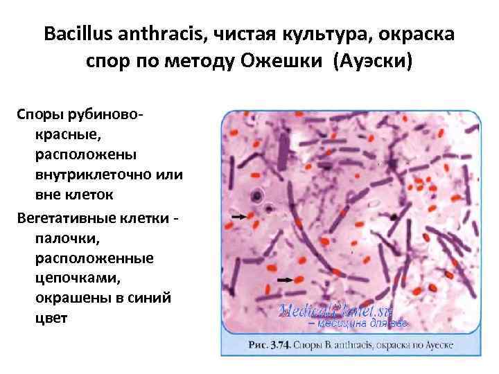 Bacillus anthracis, чистая культура, окраска спор по методу Ожешки (Ауэски) Споры рубиновокрасные, расположены внутриклеточно