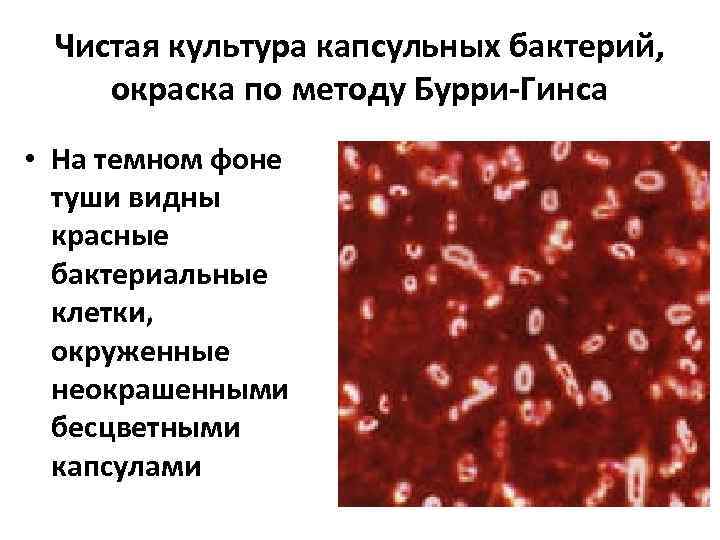 Метод бурри гинса. Klebsiella pneumoniae Бурри Гинса. Метод Бурри Гинса микробиология. Капсулы Klebsiella pneumoniae. Окраска по Бурри-ГИНСУ. Окраска по Бурри ГИНСУ микробиология.