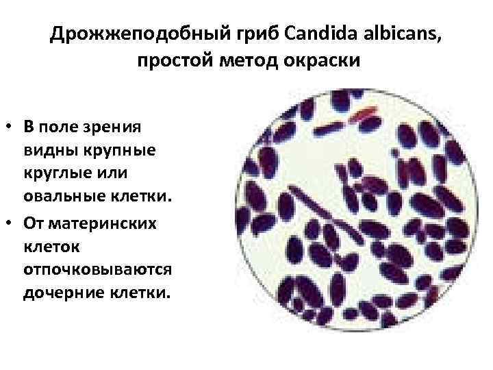 Дрожжеподобный гриб Сandida albicans, простой метод окраски • В поле зрения видны крупные круглые