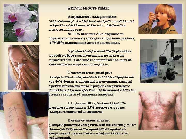 АКТУАЛЬНОСТЬ ТЕМЫ Актуальность аллергических заболеваний (АЗ) в Украине находится в несколько «скрытом» состоянии, оставаясь