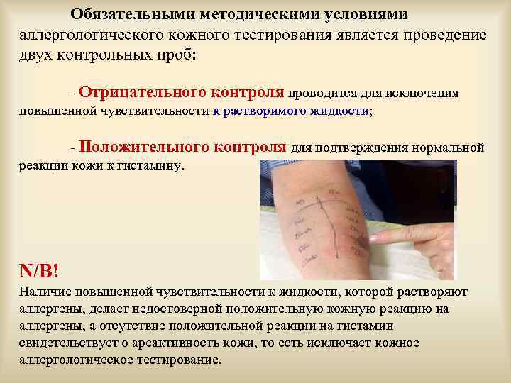 Обязательными методическими условиями аллергологического кожного тестирования является проведение двух контрольных проб: - Отрицательного контроля
