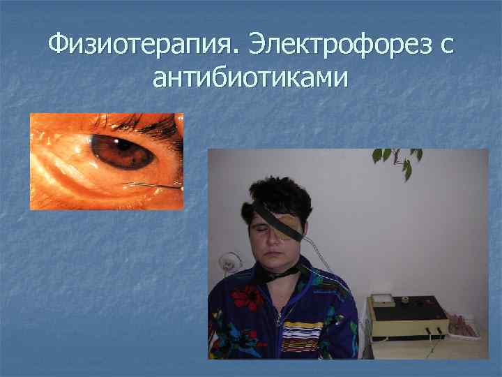 Физиотерапия. Электрофорез с антибиотиками 