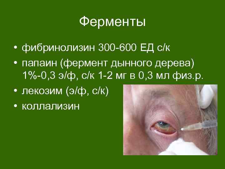 Ферменты • фибринолизин 300 -600 ЕД с/к • папаин (фермент дынного дерева) 1%-0, 3