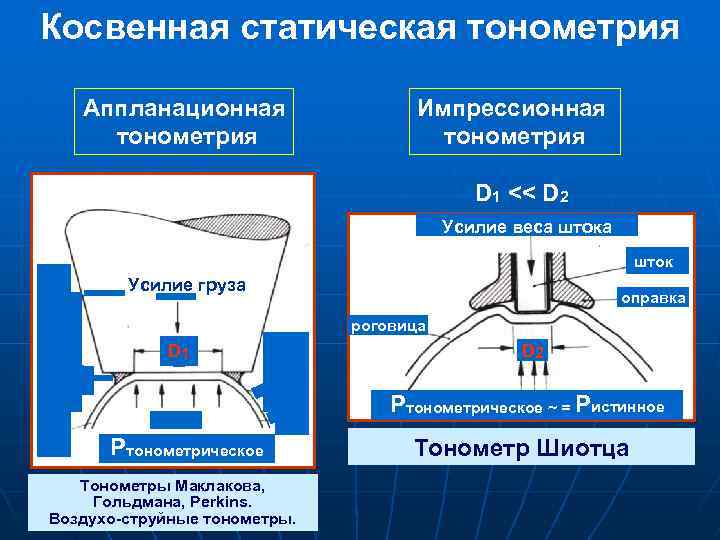 Косвенная статическая тонометрия Аппланационная тонометрия Импрессионная тонометрия D 1 << D 2 Усилие веса