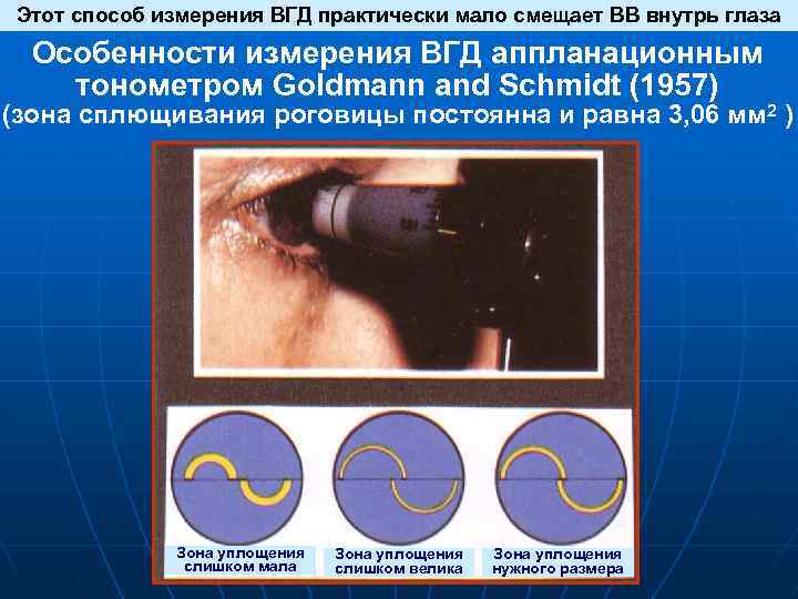 Этот способ измерения ВГД практически мало смещает ВВ внутрь глаза Особенности измерения ВГД аппланационным