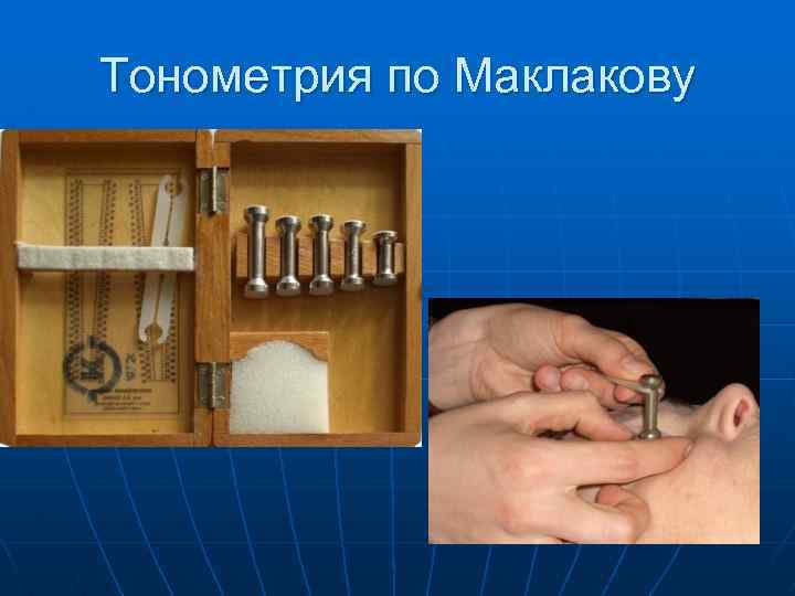 Тонометрия по Маклакову 