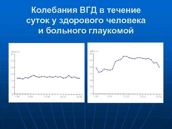 Колебания ВГД в течение суток у здорового человека и больного глаукомой 