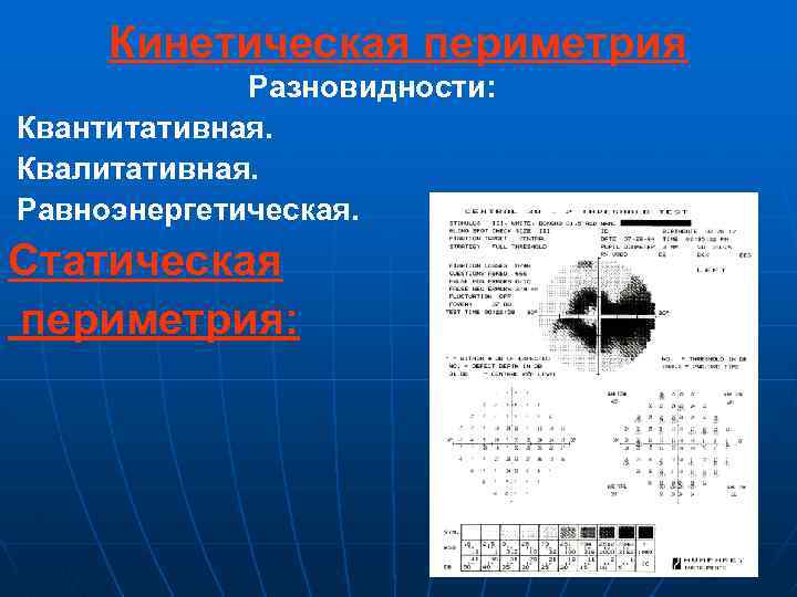 Кинетическая периметрия