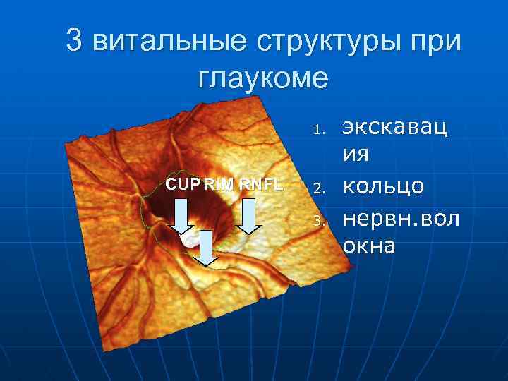 3 витальные структуры при глаукоме 1. CUP RIM RNFL 2. 3. экскавац ия кольцо