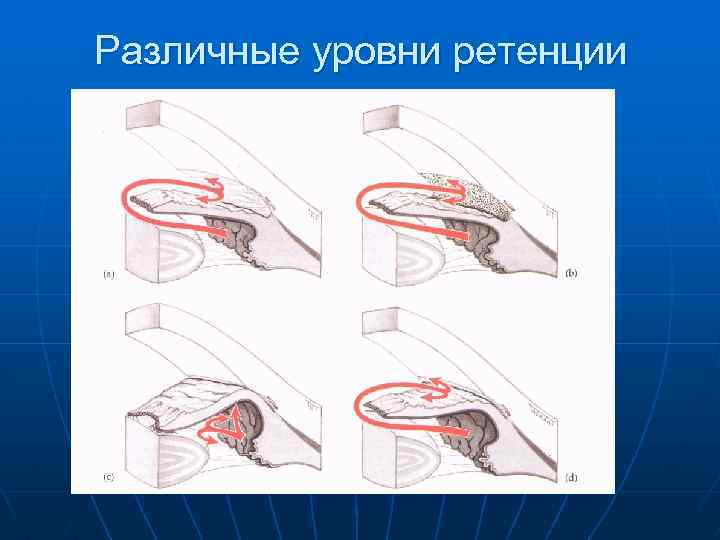 Различные уровни ретенции 