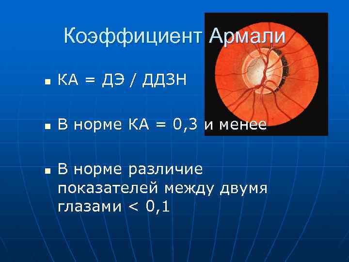 Коэффициент Армали n КА = ДЭ / ДДЗН n В норме КА = 0,