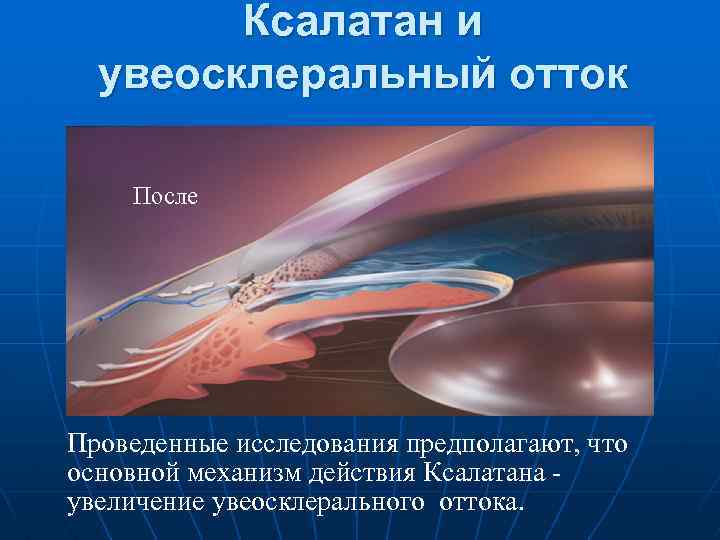 Ксалатан и увеосклеральный отток После Проведенные исследования предполагают, что основной механизм действия Ксалатана увеличение