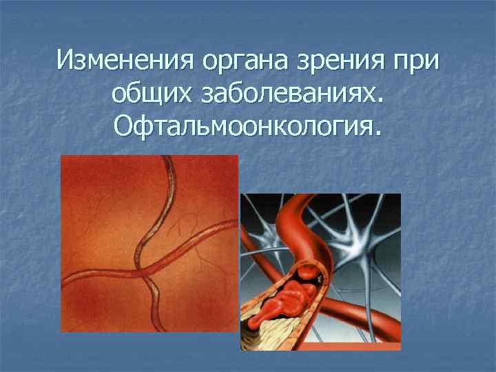 Изменения органа зрения при общих заболеваниях. Офтальмоонкология. 