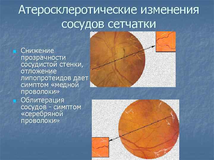 Постнатальные изменения в сосудистой стенке