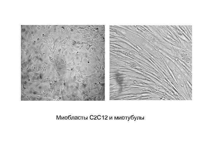 Миобласты С 2 С 12 и миотубулы 