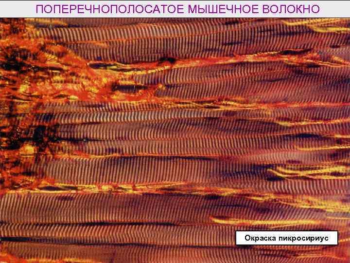 Мышечные волокна в кале у взрослого фото