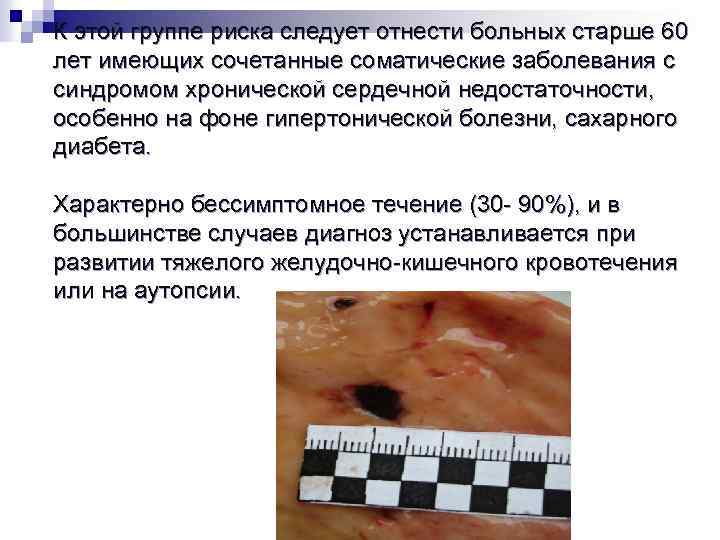 К этой группе риска следует отнести больных старше 60 лет имеющих сочетанные соматические заболевания