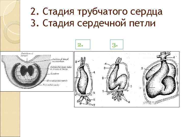 2. Стадия трубчатого сердца 3. Стадия сердечной петли 2. 3. 