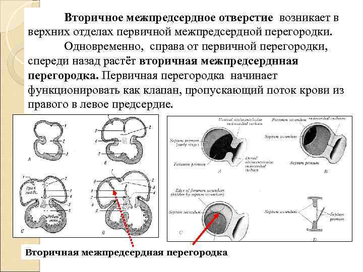 Вторичное межпредсердное отверстие возникает в верхних отделах первичной межпредсердной перегородки. Одновременно, справа от первичной
