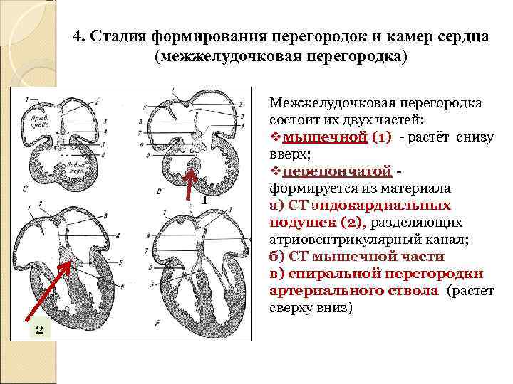 4. Стадия формирования перегородок и камер сердца (межжелудочковая перегородка) 1 2 Межжелудочковая перегородка состоит