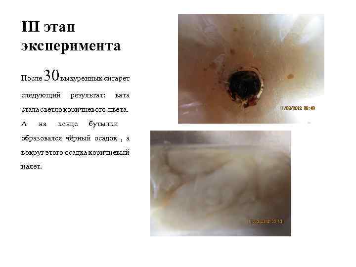 III этап эксперимента 30 выкуренных сигарет После следующий результат: вата стала светло коричневого цвета.