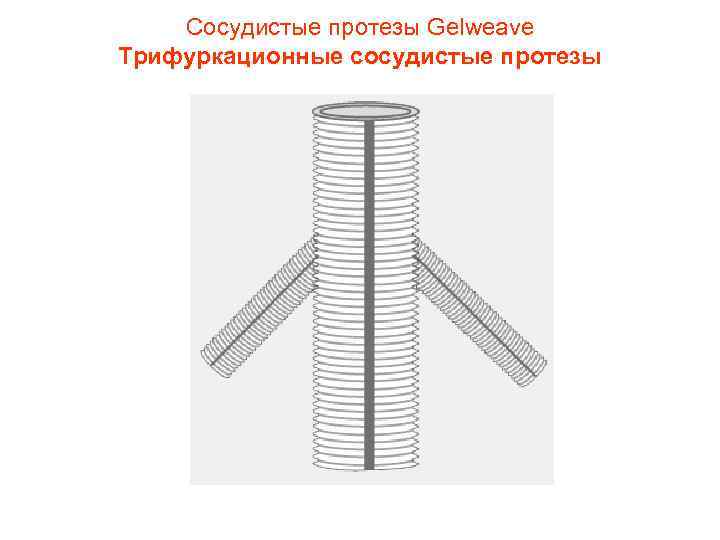 Сосудистые протезы Gelweave Трифуркационные сосудистые протезы 