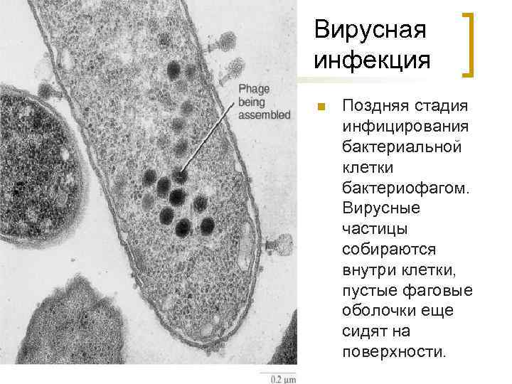 Вирусная инфекция n Поздняя стадия инфицирования бактериальной клетки бактериофагом. Вирусные частицы собираются внутри клетки,