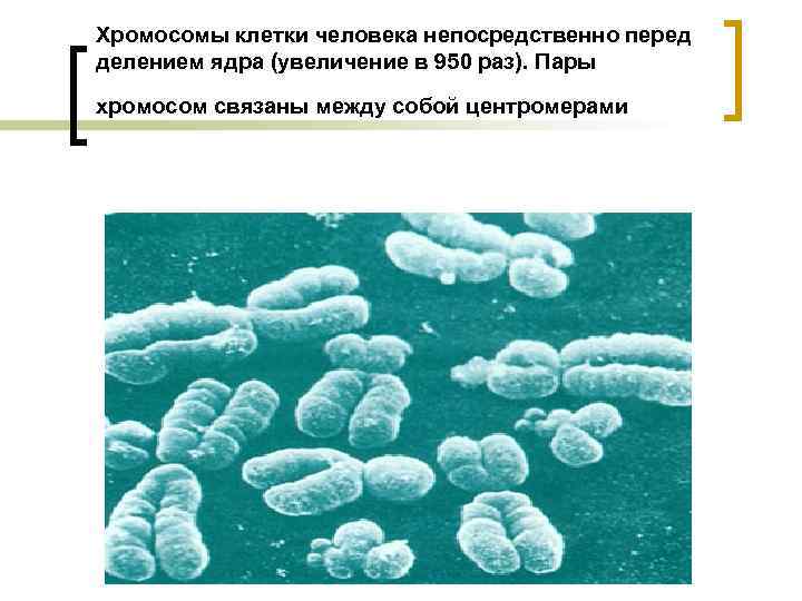 Хромосомы клетки человека непосредственно перед делением ядра (увеличение в 950 раз). Пары хромосом связаны
