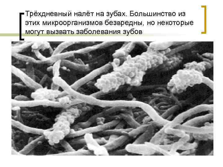 Трёхдневный налёт на зубах. Большинство из этих микроорганизмов безвредны, но некоторые могут вызвать заболевания