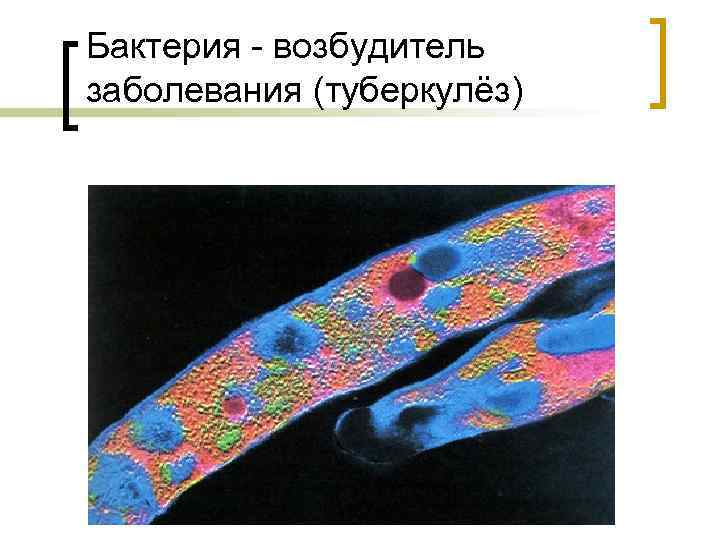 Бактерия возбудитель заболевания (туберкулёз) 