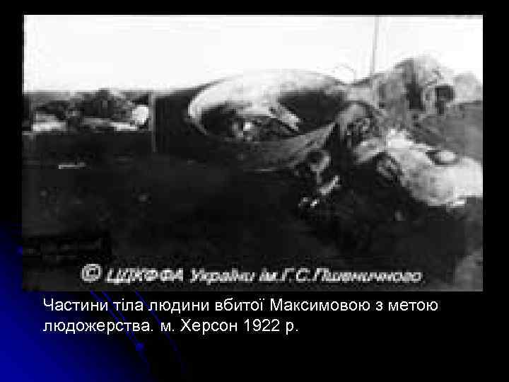 Частини тіла людини вбитої Максимовою з метою людожерства. м. Херсон 1922 р. 