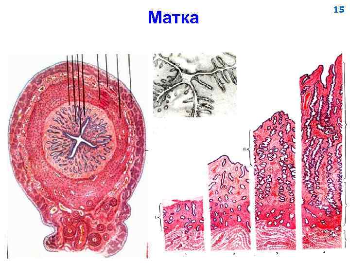 Матка 15 