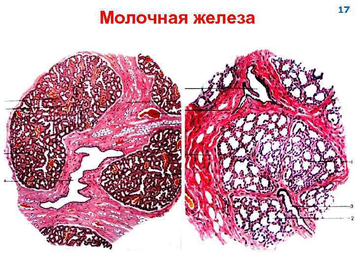 Молочная железа 17 