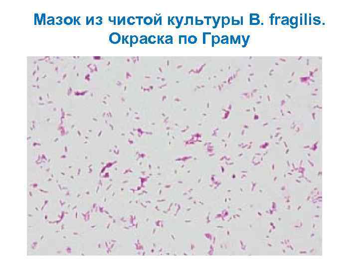 Мазок из чистой культуры B. fragilis. Окраска по Граму 