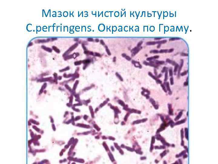 Мазок из чистой культуры C. perfringens. Окраска по Граму. 