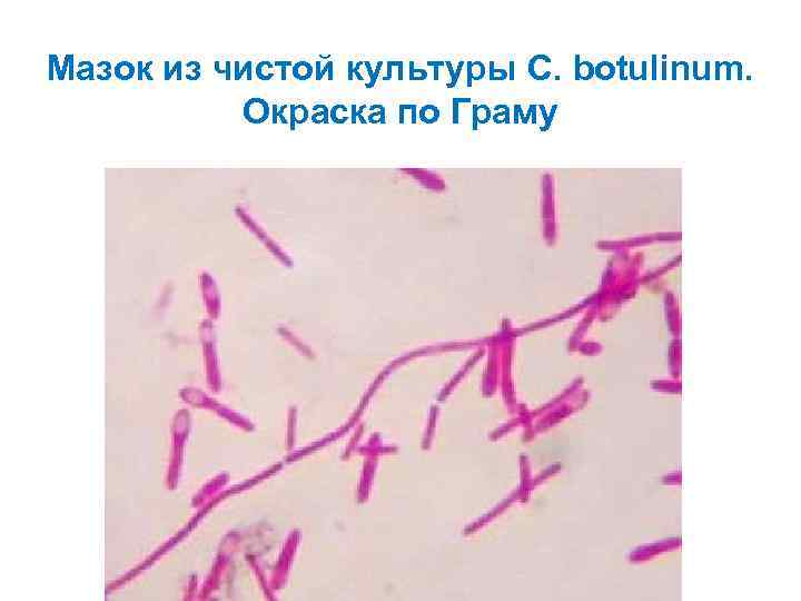 Мазок из чистой культуры C. botulinum. Окраска по Граму 