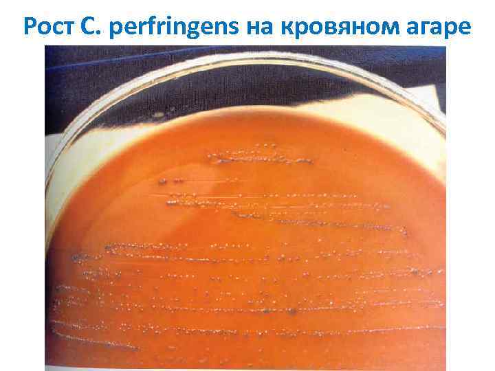 Рост C. perfringens на кровяном агаре 