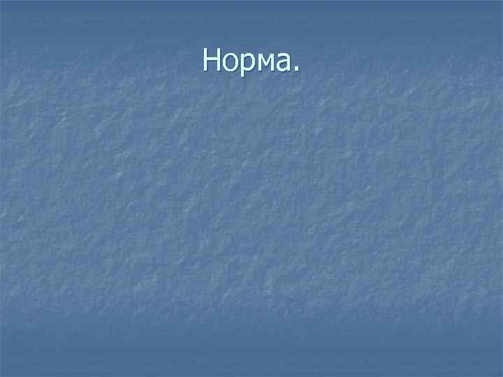 Норма. 