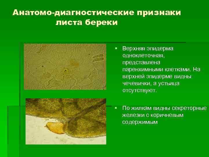 Анатомо-диагностические признаки листа береки § Верхняя эпидерма одноклеточная, представлена паренхимными клетками. На верхней эпидерме