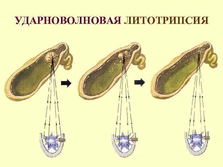 Гепатобилиарная система картинка