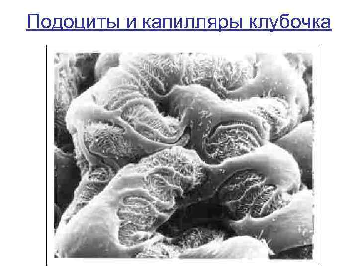 Подоциты и капилляры клубочка 