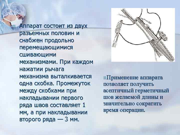 n Аппарат состоит из двух разъемных половин и снабжен продольно перемещающимися сшивающими механизмами. При