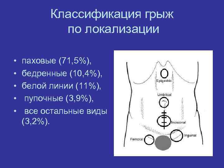 Классификация грыж