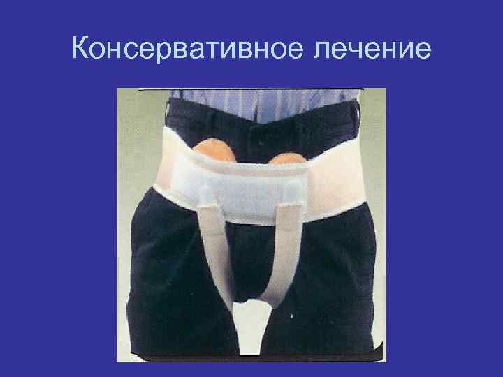 Консервативное лечение 