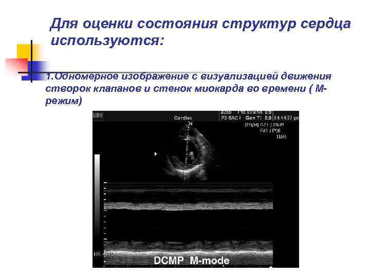 Для оценки состояния структур сердца используются: n 1. Одномерное изображение с визуализацией движения створок