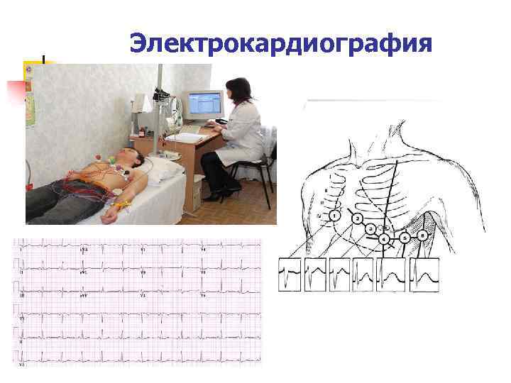 Электрокардиография 