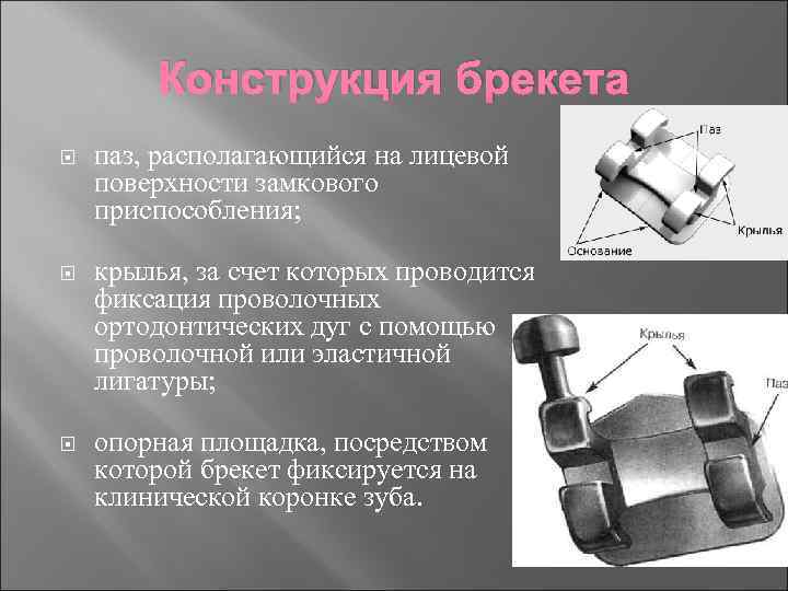 Брекеты проект 10 класс