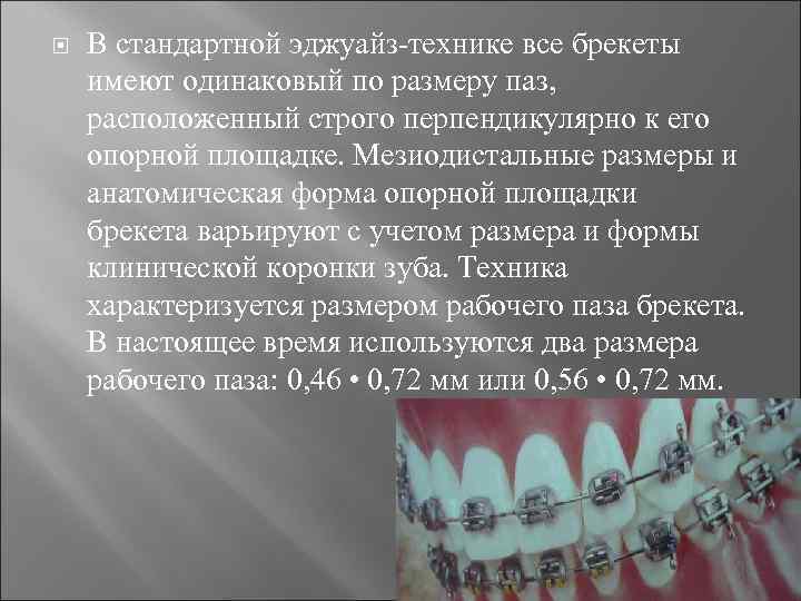  В стандартной эджуайз технике все брекеты имеют одинаковый по размеру паз, расположенный строго