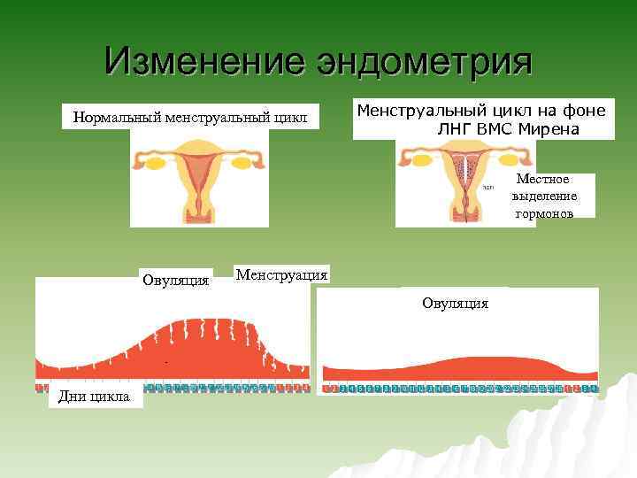 Изменение эндометрия Нормальный менструальный цикл Менструальный цикл на фоне ЛНГ ВМС Мирена Местное выделение